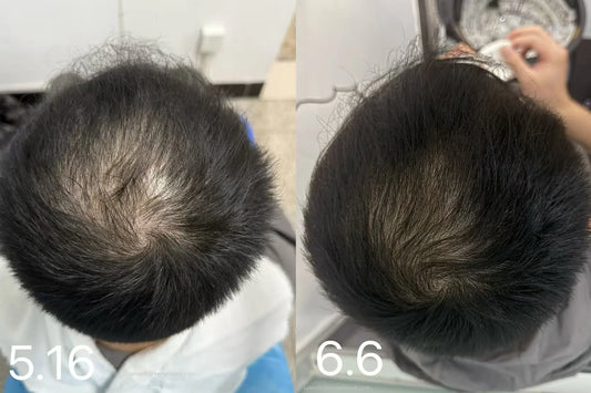 Hair Growth Cap For Hair Regrowth & Hair Loss Treatment 650nm Red Light Therapy Cap For Men & Women