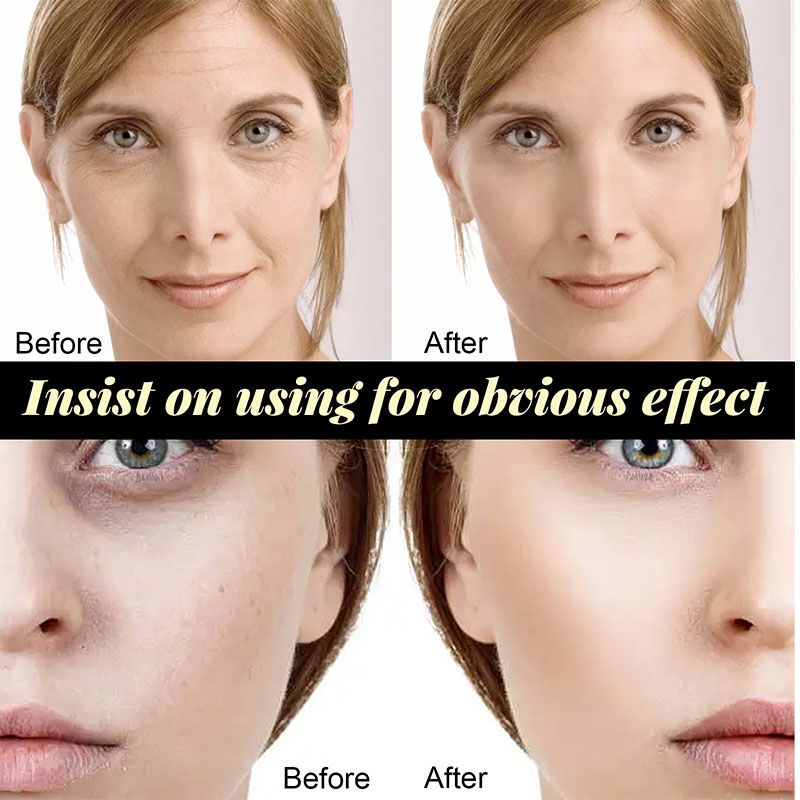 comparing before and after insist on using for obvious effect.