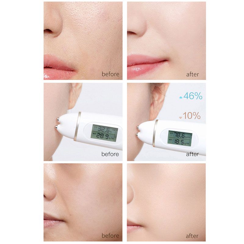 Before and after comparison of a skincare device