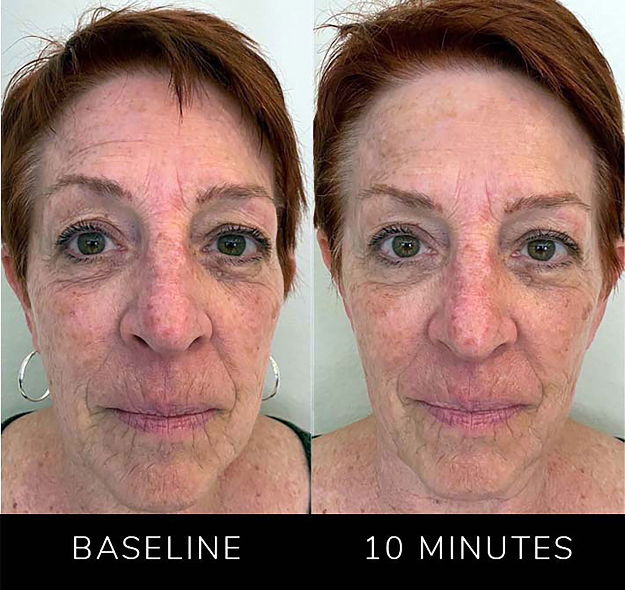 comparison of a woman's face with visible skin texture in 10 minutes.